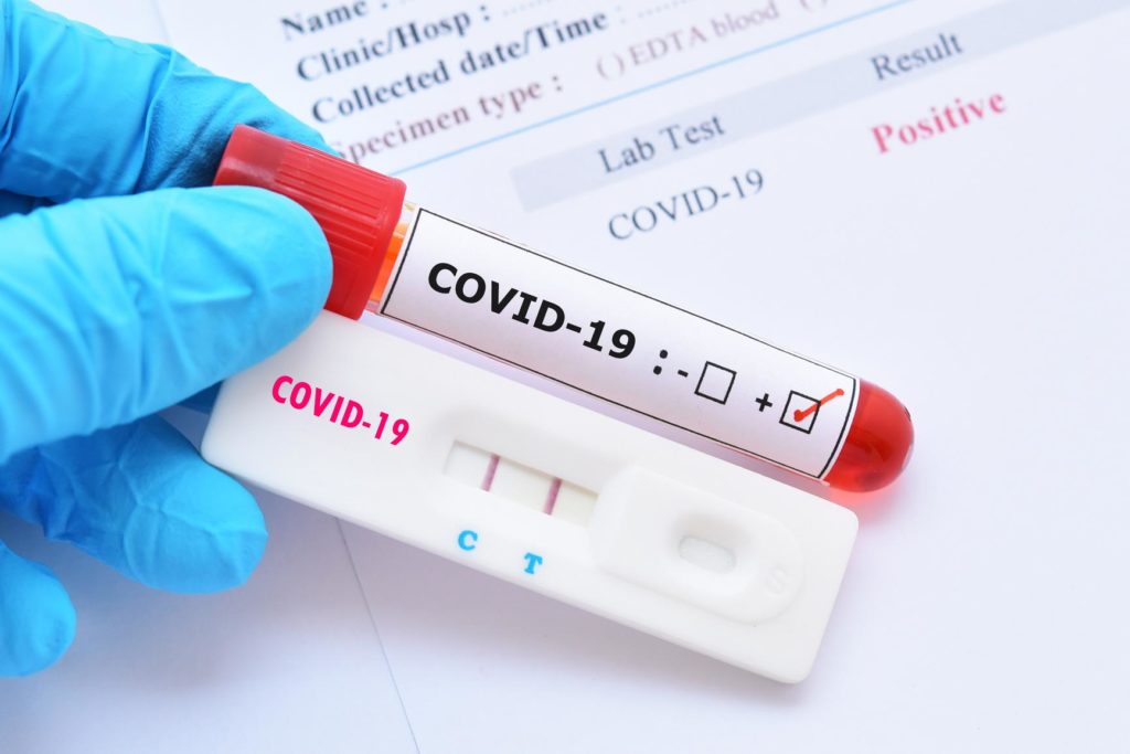 الإمارات تسجيل 321 إصابة جديدة بفيروس كورونا