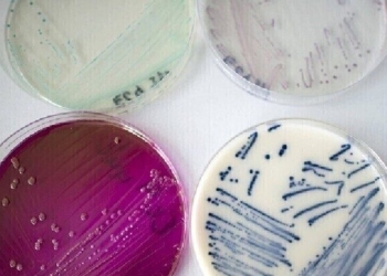 العلماء يبتكرون طريقة لمكافحة البكتيريا المقاومة لمضادات الحيوية