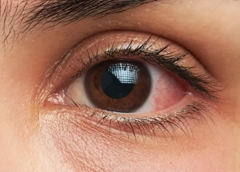 عين