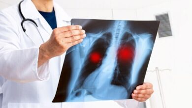 سرطان الرئة.. معلومات هامة عليك أن تعرفها الآن