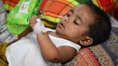 الحصبة تودي بألف طفل في بنغلاديش